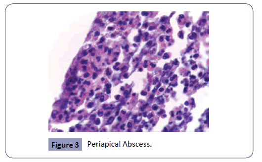 Evaluation of the Histopathological Findings of 128 Persistent